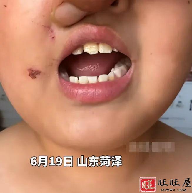 拿针扎、撕嘴巴、磕掉牙？小学生称遭到班主任连续多次虐待！